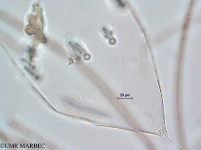 phyto/Scattered_Islands/all/COMMA April 2011/Rhizosolenia robusta (3)(copy)_thumb.jpg